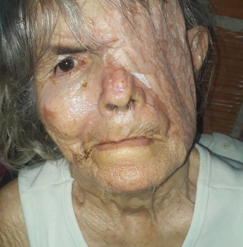 Mariazinha pede socorro - Ajudem essa senhora de 80 anos